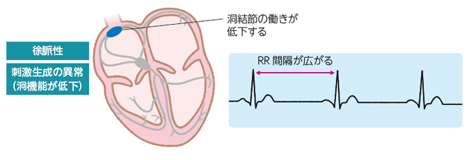 洞不全症候群：SSS| かんテキWeb