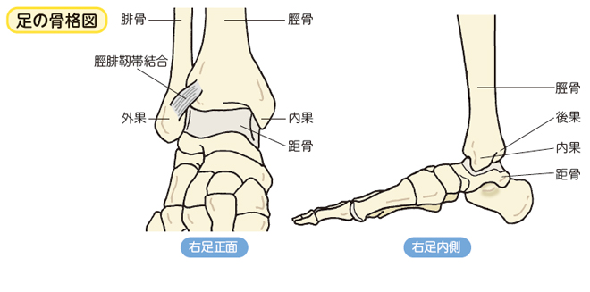 足関節果部骨折：| かんテキWeb