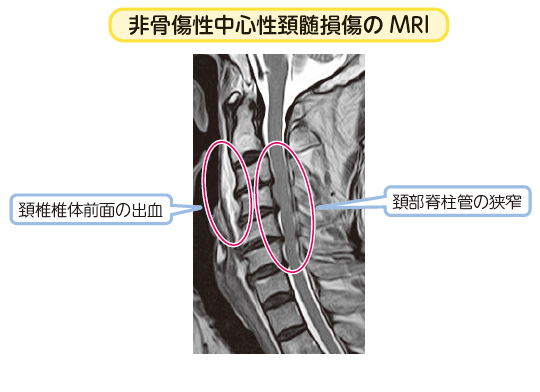 日本最大の 【裁断済】脊椎脊髄損傷アドバンス 健康・医学 - www 