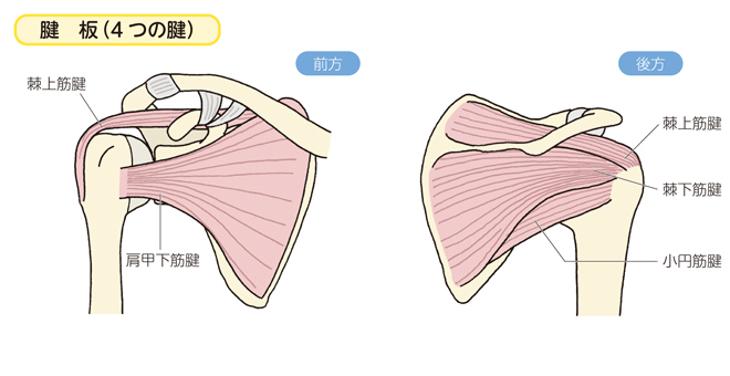 ストア ショルダーハーネス 棘上筋断裂