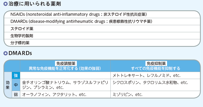 関節リウマチの治療：| かんテキWeb